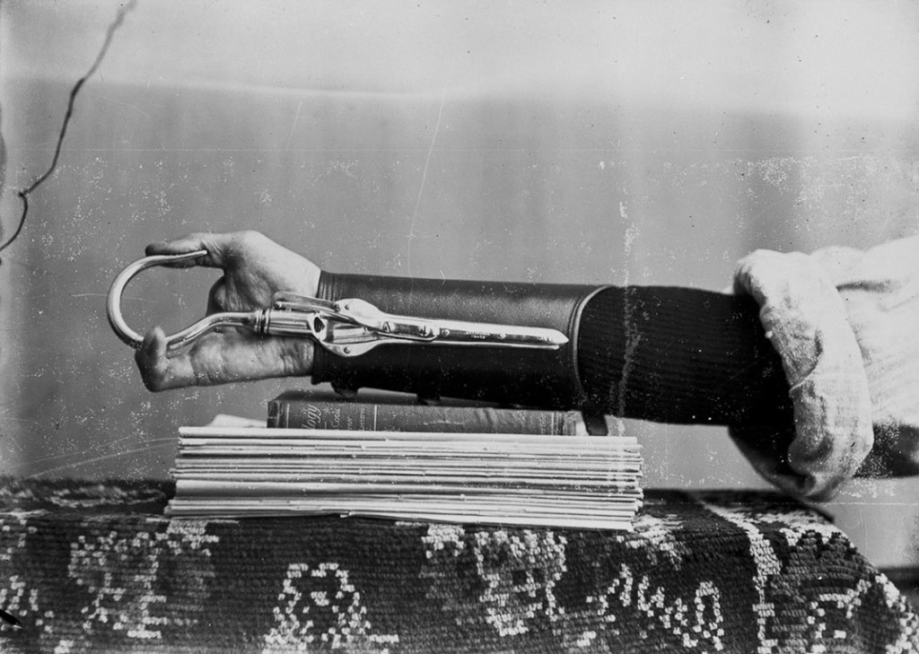 These-Ingenious-prostheses-From-19th-century-helped-15000-People-Regain-Mobility-11