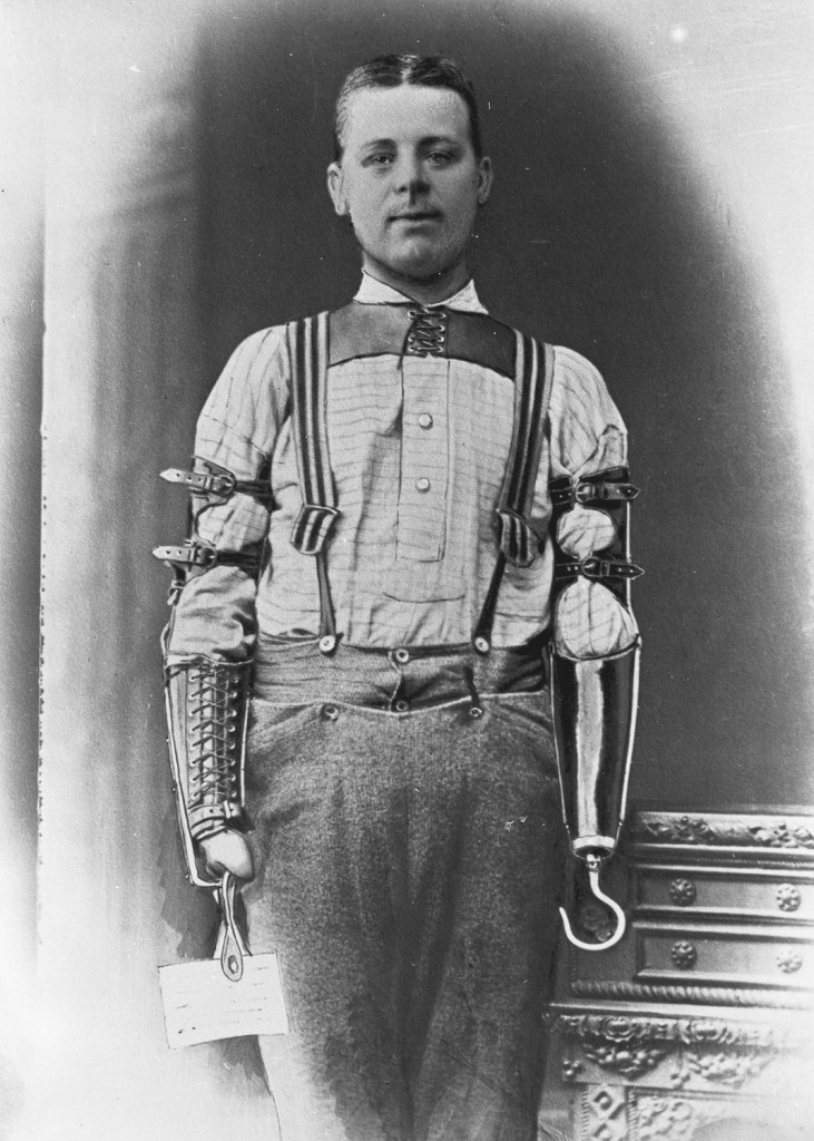 These-Ingenious-prostheses-From-19th-century-helped-15000-People-Regain-Mobility-110