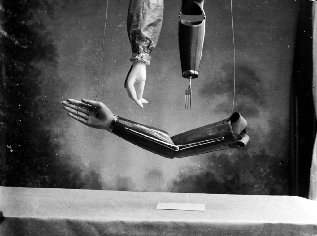 These-Ingenious-prostheses-From-19th-century-helped-15000-People-Regain-Mobility-121
