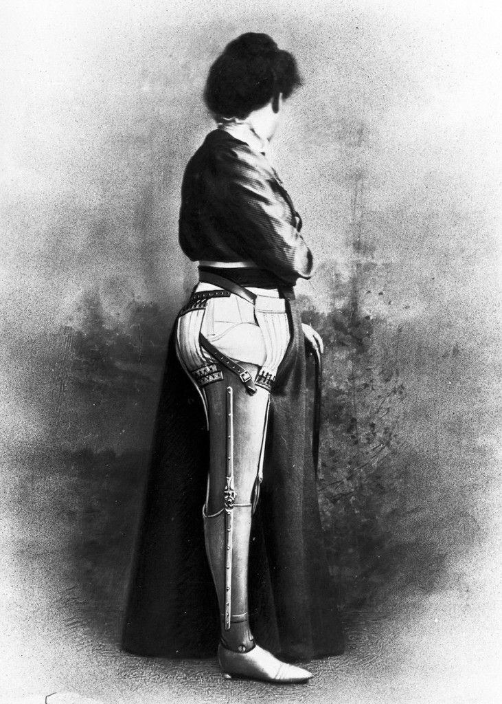 These-Ingenious-prostheses-From-19th-century-helped-15000-People-Regain-Mobility-17