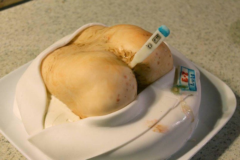 day-rectal-cake-805x536